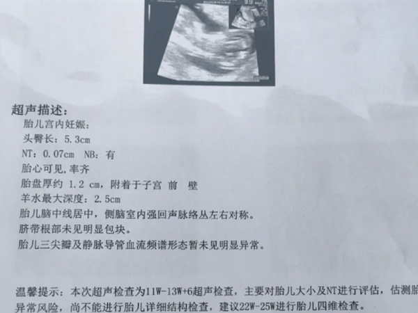 38岁4月怀孕是男孩还是女孩？读懂清宫表图你就知道